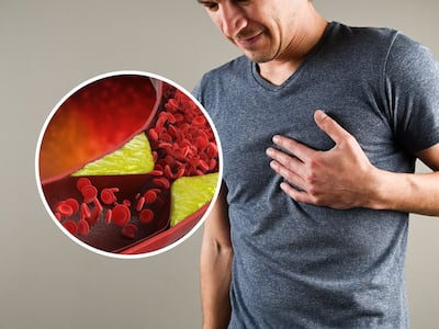 High Cholesterol Management: 10 Tips To Lower High Cholesterol Levels ...