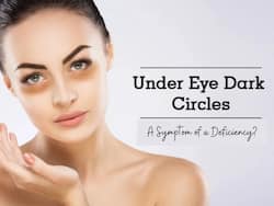 5 Vitamin Deficiencies That Can Cause Dark Circles Under Your Eyes