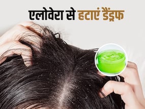 सर्दियों में डैंड्रफ हटाने के लिए यूज करें एलोवेरा हेयर मास्क, जानें बनाने का तरीका