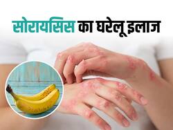 World Psoriasis Day: इस फल के छिलके से करें सोरायसिस का इलाज, जानें प्रयोग का तरीका