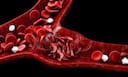 The Role Of Advanced Flow Cytometry In Multiple Hematological Disorders