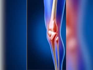 हड्डियों से कैल्शियम को खत्म कर देते हैं ये फूड आइटम