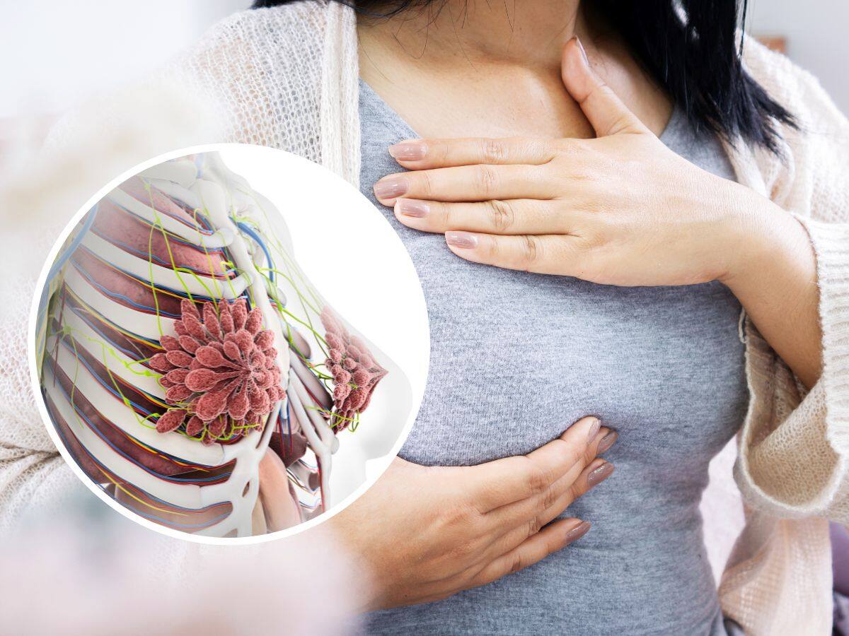 Breast Cancer In Women 5 Factors That Can Increase The Risk Of Breast