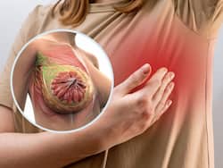 Breast Cancer Symptoms Management: 7 Healthy Lifestyle Choices to Reduce Your Breast Cancer Risk