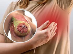 Breast Cancer Symptoms Management: 7 Healthy Lifestyle Choices to Reduce Your Breast Cancer Risk