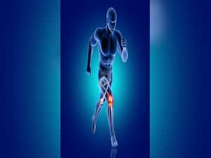 10 Disease Which Can Affect Your Bone Health