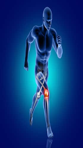 10 Disease Which Can Affect Your Bone Health
