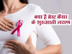 Breast Cancer : क्या हैं ब्रेस्ट कैंसर के शुरुआती लक्षण, नजरअंदाज करना हो सकता है जानलेवा