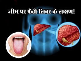 जीभ पर भी दिखते हैं फैटी लिवर के लक्षण, भूलकर भी न करें नजरंदाज जीभ पर भी दिखते हैं फैटी लिवर के लक्षण, भूलकर भी न करें नजरंदाज