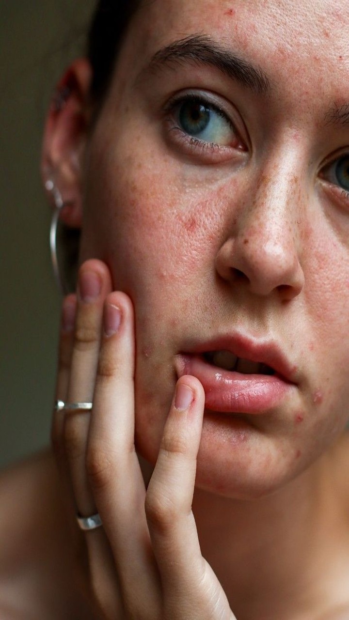 9 Eating Habits That Might Harm Your Skin