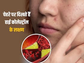 चेहरे पर नजर आएं ये 5 बदलाव, तो समझ जाइए बढ़ गया है कोलेस्ट्रॉल, तुरंत करवाएं इलाज