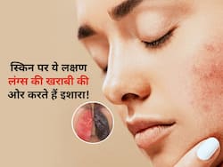 рд╕реНрдХрд┐рди рдкрд░ рджрд┐рдЦ рд░рд╣реЗ рдЗрди 5 рд▓рдХреНрд╖рдгреЛрдВ рд╕реЗ рд╕рдордЭ рдЬрд╛рдПрдВ рдЦрд░рд╛рдм рд╣реЛ рдЪреБрдХрд╛ рд╣реИ рд▓рдВрдЧреНрд╕, рддреБрд░рдВрдд рдЕрдкрдирд╛рдПрдВ рдЕрдкрдиреА рдЬрд╛рдВрдЪ