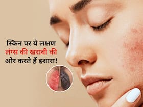स्किन पर दिख रहे इन 5 लक्षणों से समझ जाएं खराब हो चुका है लंग्स, तुरंत अपनाएं अपनी जांच