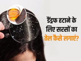 डैंड्रफ से छुटकारा दिला सकता है सरसों का तेल, इन 4 तरीकों से करें इस्तेमाल