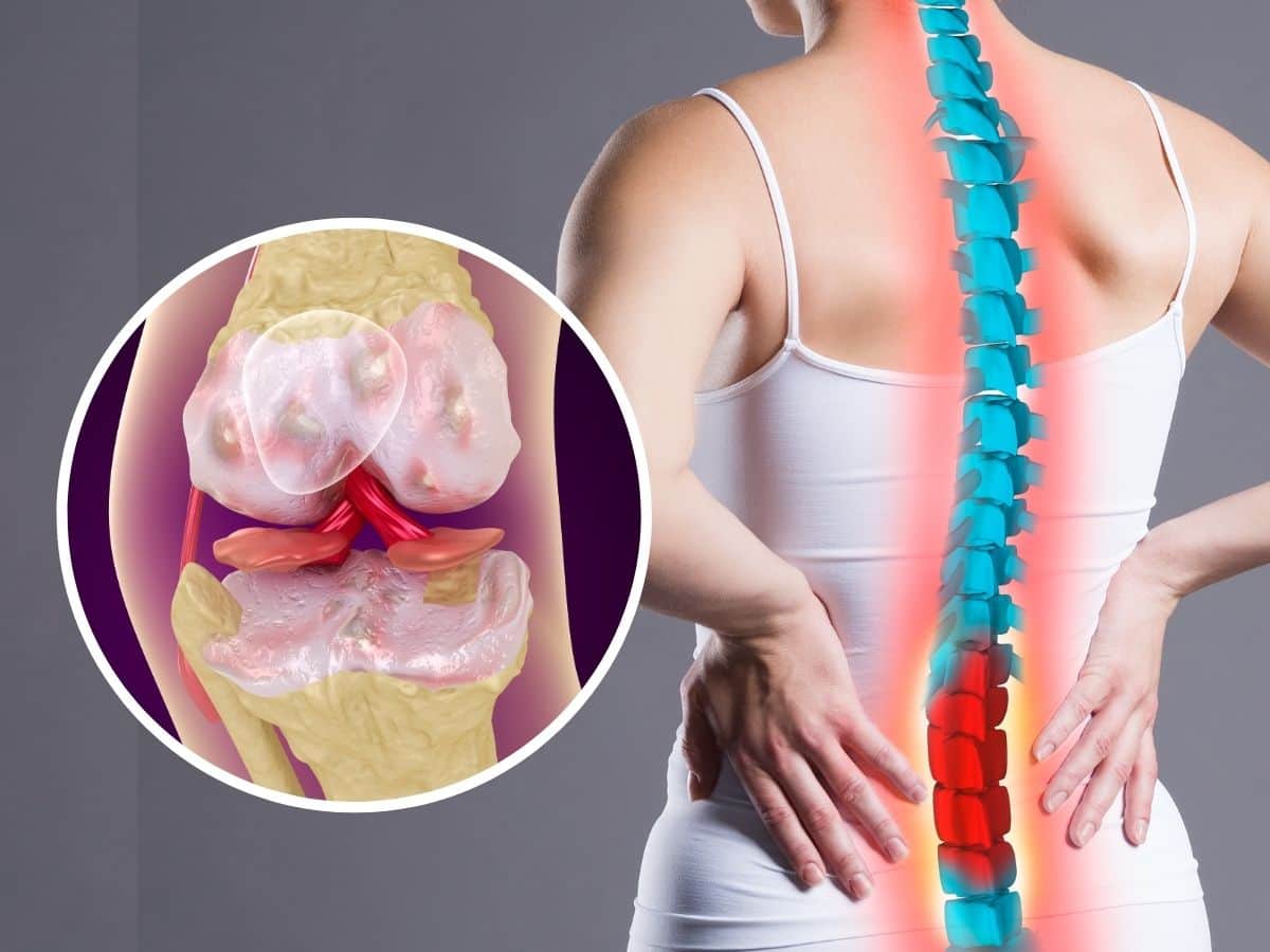 Osteoporosis Symptoms Can Be Dangerous: Beware These 5 Lifestyle Habits That Could Severely Damage Your Bo - TheHealthSite