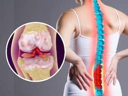 Osteoporosis Symptoms Can Be Dangerous: Beware of These 5 Lifestyle Habits That Could Severely Damage Your Bones, Joints