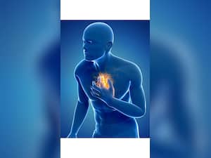 Top 7 Foods A Heart Patient Should Avoid