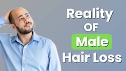 Hair Loss : Unveiling Male Hair Loss Trends in India
