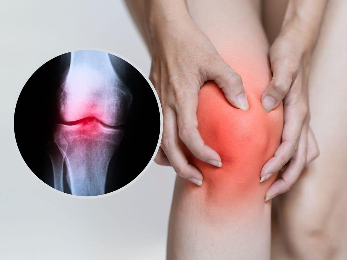 bone and joint pain - Exploring rheumatoid arthritis and its impact