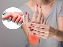 Rheumatoid Arthritis Inflammation: 5 Best Treatment Options for Arthritis Induced Joint Pain