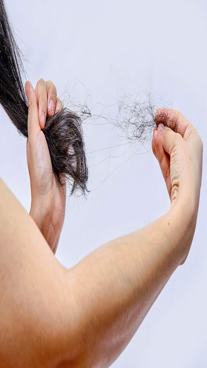 Say No To Hair Fall By Adding These 7 Foods In Your Diet