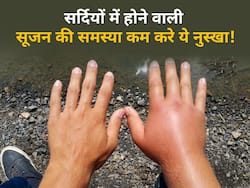 सर्दियों में हाथ-पैरों में सूजन को कम करने के लिए अपनाएं ये 5 तरह के नुस्खे, झुनझुनी और कंपन्न से भी मिलेगा छुटकारा