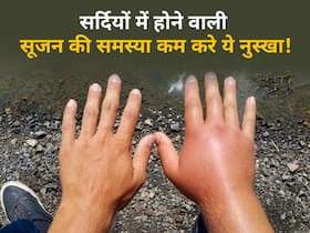 सर्दियों में हाथ-पैरों में सूजन को कम करने के लिए अपनाएं ये 5 तरह के नुस्खे, झुनझुनी और कंपन्न से भी मिलेगा छुटकारा