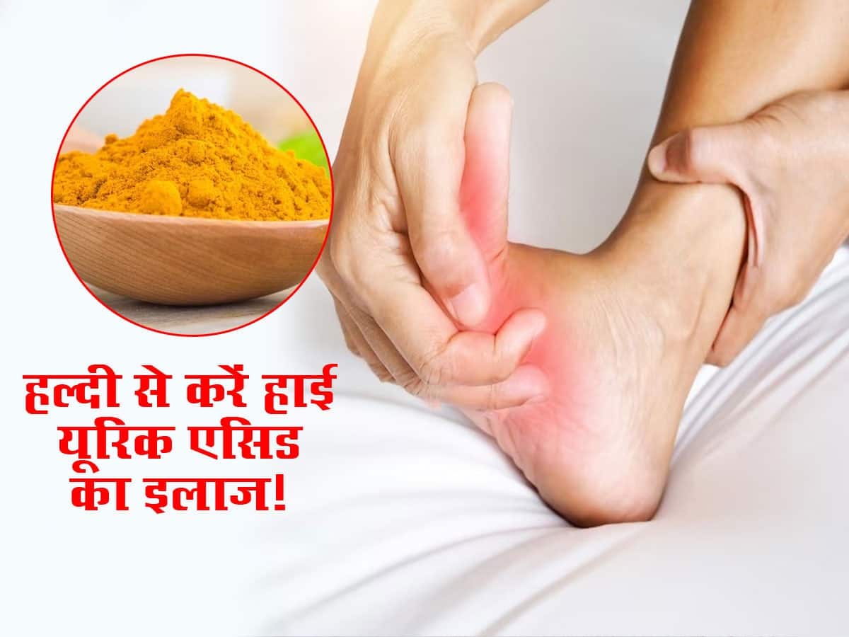 How To Use Turmeric For Uric Acid जोड़ों में जमा यूरिक एसिड को
