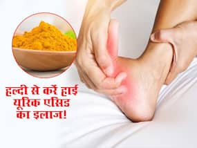 जोड़ों में जमा यूरिक एसिड को पिघलाकर बाहर निकाल देगी हल्दी, जानें कैसे करें इस्तेमाल