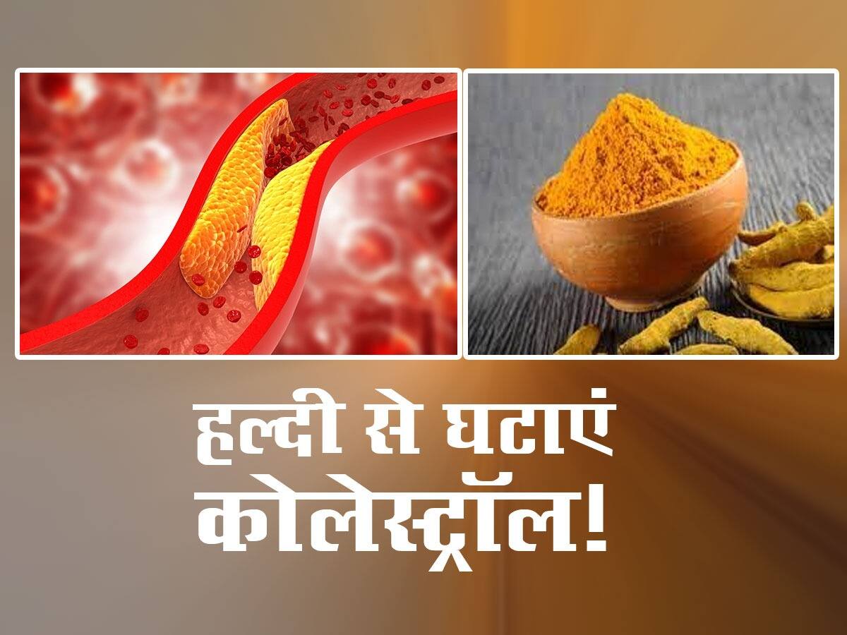 Turmeric for Cholesterol हल्दी से 1 सप्ताह में बैड कोलेस्ट्रॉल के