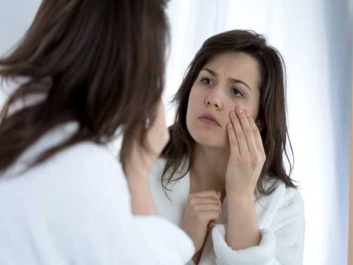 5 Vitamin Deficiencies That Can Cause Dark Circles Under Your Eyes