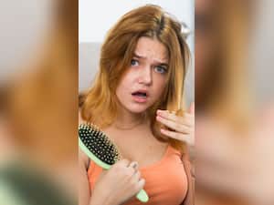 Winter Haircare Tips for Dandruff and Hair Fall: 8 Easy Ways To Stop Hair Loss During Winter