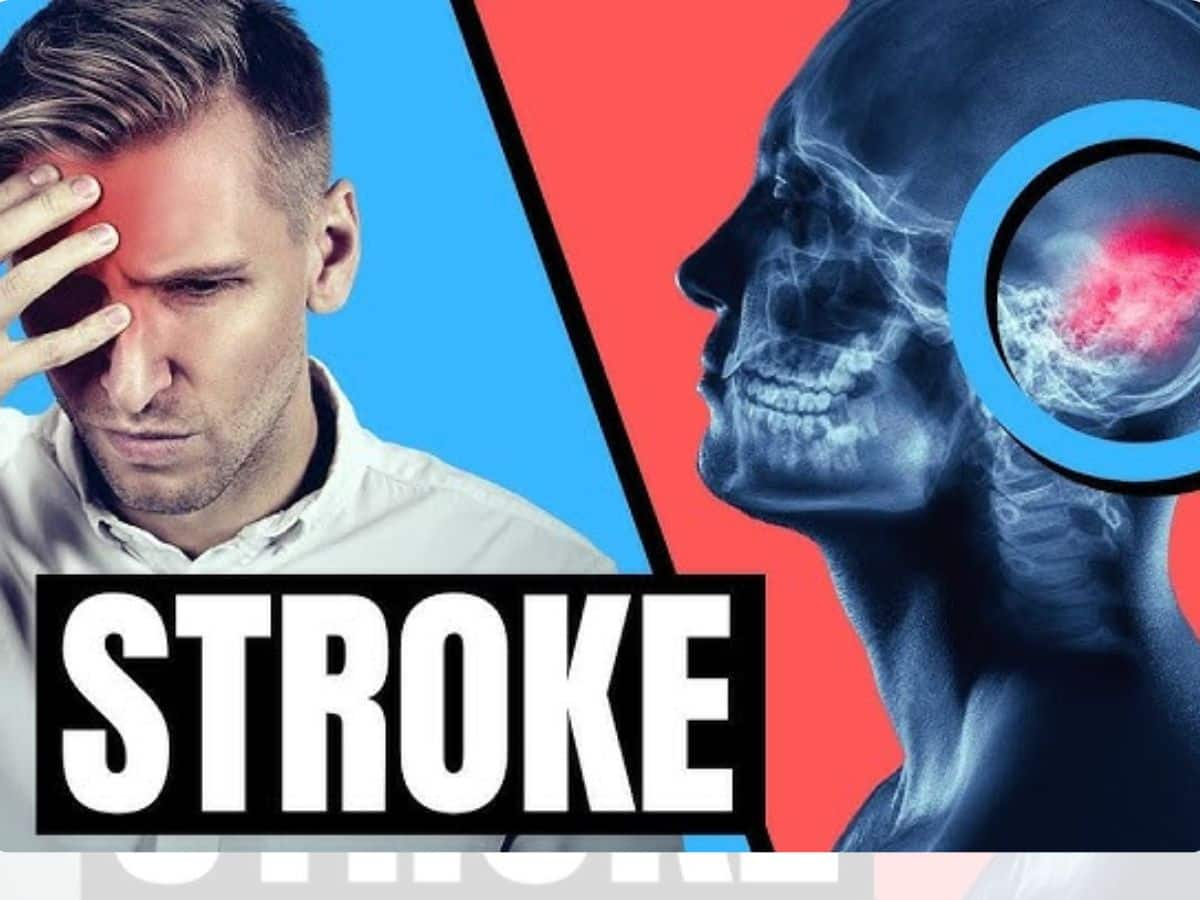 World Stroke Day 2023: 10 Stroke Prevention Tips That Will Help You ...