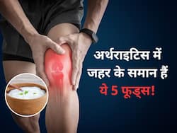 World Arthritis Day: गठिया के मरीज भूलकर भी न खाएं ये 5 फूड्स, जोड़ों के दर्द से हो जाएंगे परेशान