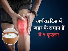 World Arthritis Day: गठिया के मरीज भूलकर भी न खाएं ये 5 फूड्स, जोड़ों के दर्द से हो जाएंगे परेशान