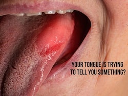 Yellow Tongue: 5 Diseases That Can Change Your Tongue Into Pale Yellow Colour