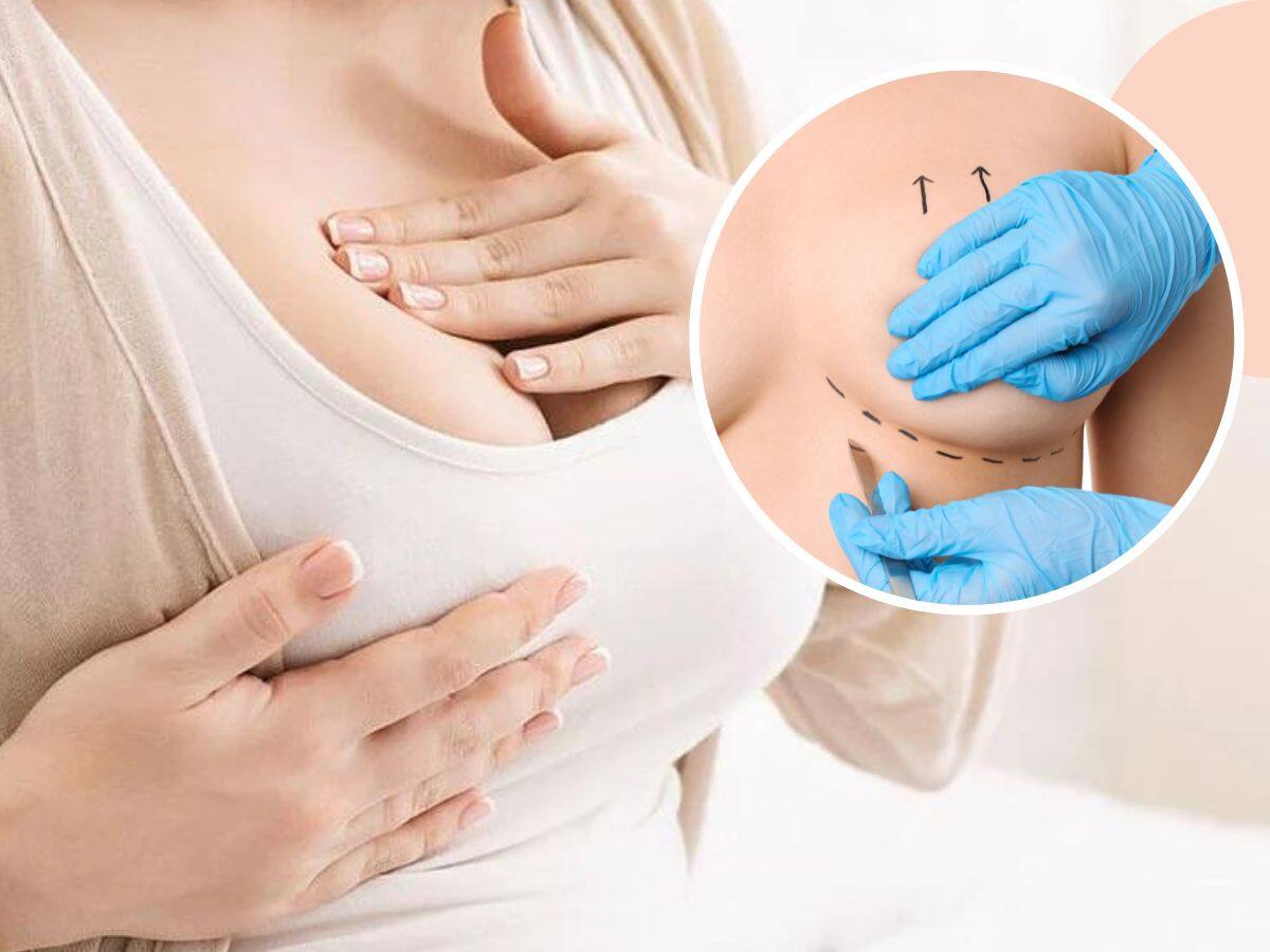 Breast Augmentation: Everything You Need to Know About the Different Types of Breast Implants - Vimarsana News