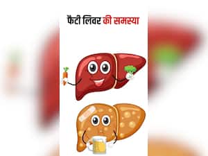 फैटी लिवर की परेशानी को दूर कर सकता है ये 8 घरेलू नुस्खे