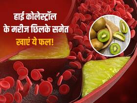 बैड कोलेस्ट्रॉल के मरीज छिलके समेत ही खाएं ये 5 सब्जियां, नसों में जमा कोलेस्ट्रॉल मोम की तरह निकल जाएगा