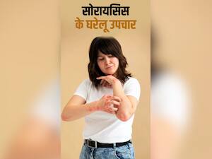 world psoriasis day: सोरायसिस से छुटकारा पाने के लिए अपनाएं ये 5 घरेलू उपाय
