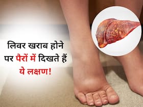 पेट पर ही नहीं लिवर खराब होने पर पैरों के आसपास भी दिखते हैं ये लक्षण, संकेत दिखने पर तुरंत हो जाएं सावधान पेट पर ही नहीं लिवर खराब होने पर पैरों के आसपास भी दिखते हैं ये लक्षण, संकेत दिखने पर तुरंत हो जाएं सावधान