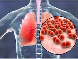 रात में सोते समय अचानक से दिखने लगते हैं ये लक्षण? समझ जाएं फेफड़े पूरी तरह से हो गए हैं खराब