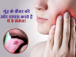 मुंह में दिख रहे इन 5 लक्षणों से समझ जाएं माउथ कैंसर के हो गए हैं शिकार, तुरंत कराएं अपनी जांच