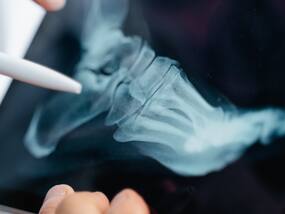 Chondrodysplasia: A Closer Look At This Rare Genetic Disorder