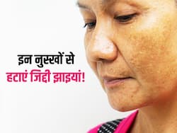 चेहरे पर जिद्दी झाइयों की वजह से खूबसूरती हो सकती है खराब, इन नुस्खों से स्किन पर लाएं चमक