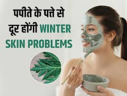 ठंड शुरू होते ही फटने लगी स्किन? सोने से पहले लगाएं पपीते के पत्ते की पेस्ट, बच्चों सी कोमल हो जाएगी स्किन