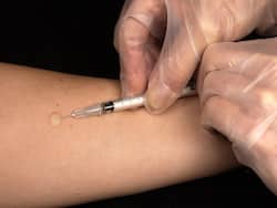 WHO Approves Second Vaccine For Children In Fight Against Malaria