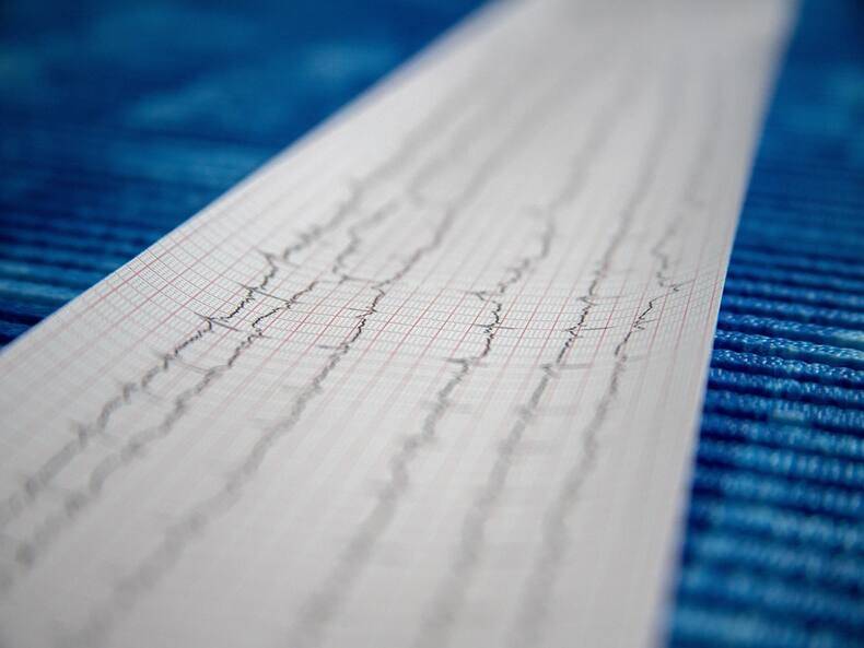 Don't Wait! Learn The 5 Early Symptoms Of Cardiogenic Shock