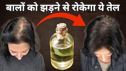How to Control Hair Fall: झड़ते हुए बालों से हैं परेशान? इस Video में है मिलेगा समाधान