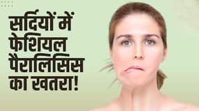 Facial Paralysis Symptoms: जानें Facial Paralysis के लक्षण और इसका इलाज
